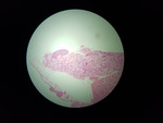 MISSING THUMBNAIL